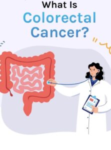 ما هو سرطان القولون والمستقيم؟
