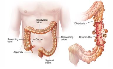 Main Causes Of Lower Abdominal Pain