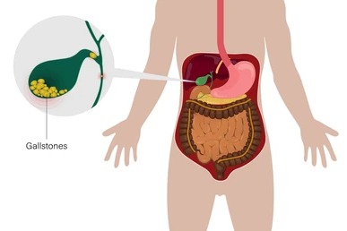 How do I know that the pancreas is inflamed