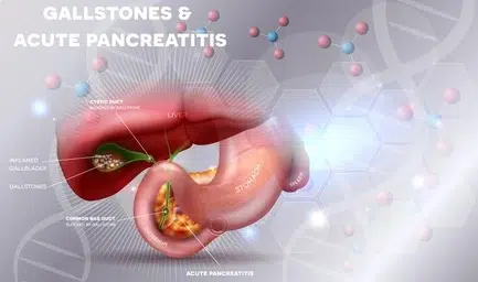 Symptoms of gallbladder disease and pancreatitis