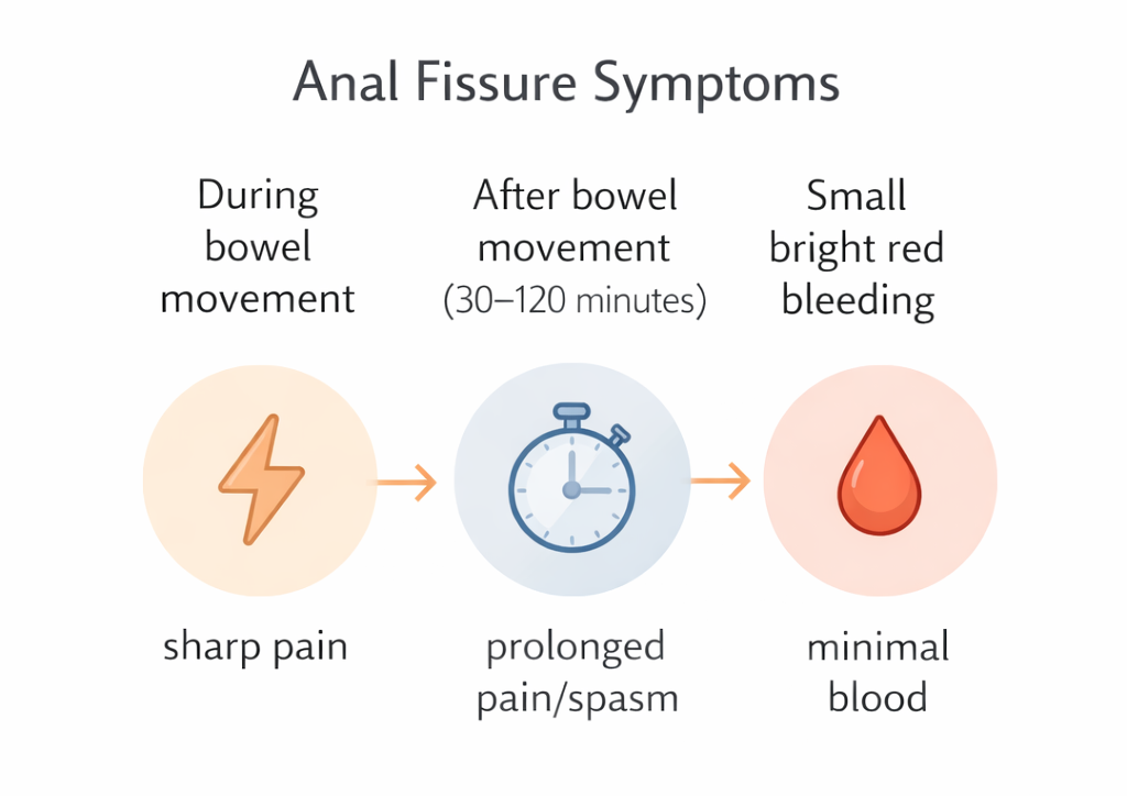 Infographic showing anal fissure symptoms including sharp pain during bowel movement and prolonged pain with minor bleeding
